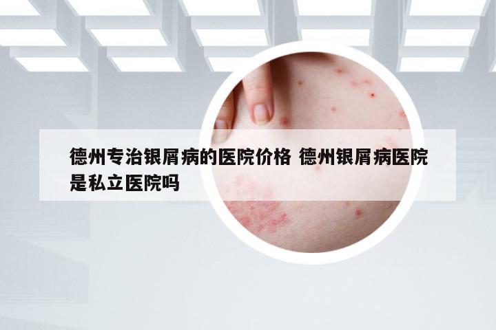 德州专治银屑病的医院价格 德州银屑病医院是私立医院吗