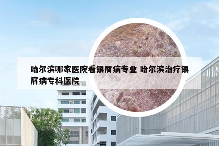 哈尔滨哪家医院看银屑病专业 哈尔滨治疗银屑病专科医院