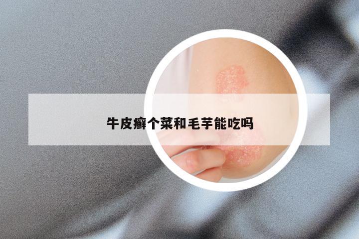 牛皮癣个菜和毛芋能吃吗