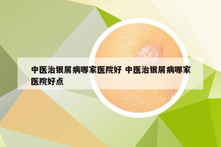 中医治银屑病哪家医院好 中医治银屑病哪家医院好点