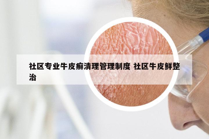 社区专业牛皮癣清理管理制度 社区牛皮鲜整治