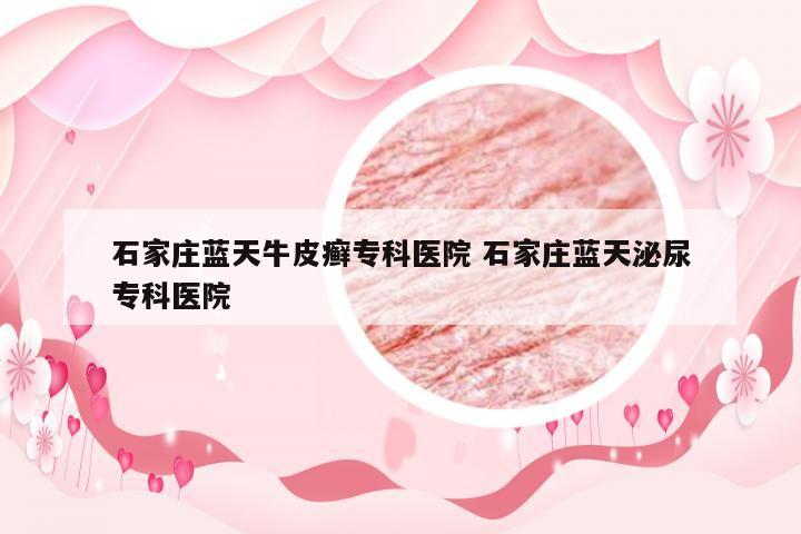 石家庄蓝天牛皮癣专科医院 石家庄蓝天泌尿专科医院