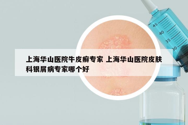 上海华山医院牛皮癣专家 上海华山医院皮肤科银屑病专家哪个好