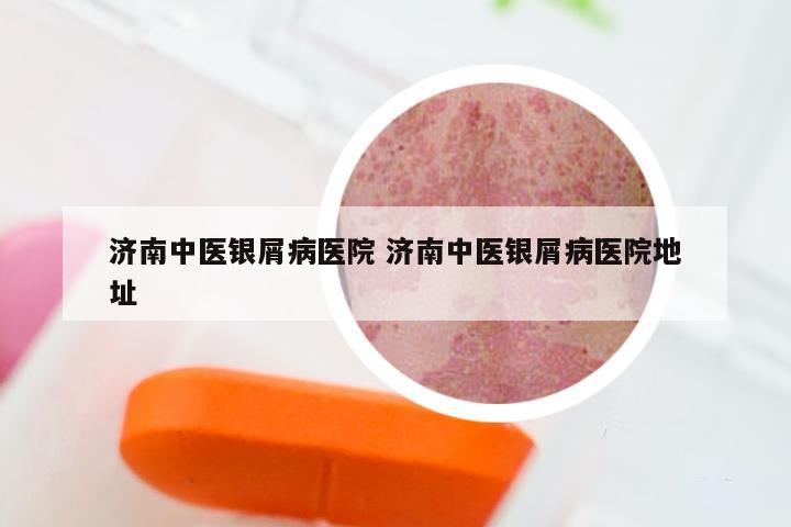 济南中医银屑病医院 济南中医银屑病医院地址