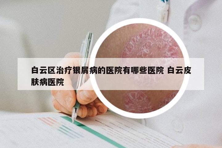 白云区治疗银屑病的医院有哪些医院 白云皮肤病医院