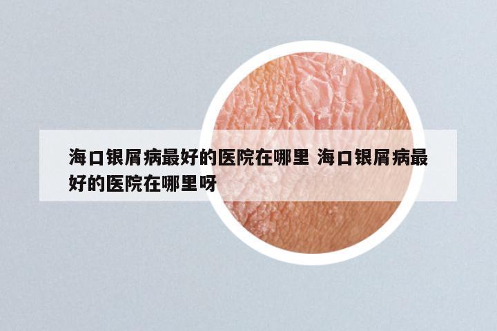 海口银屑病最好的医院在哪里 海口银屑病最好的医院在哪里呀