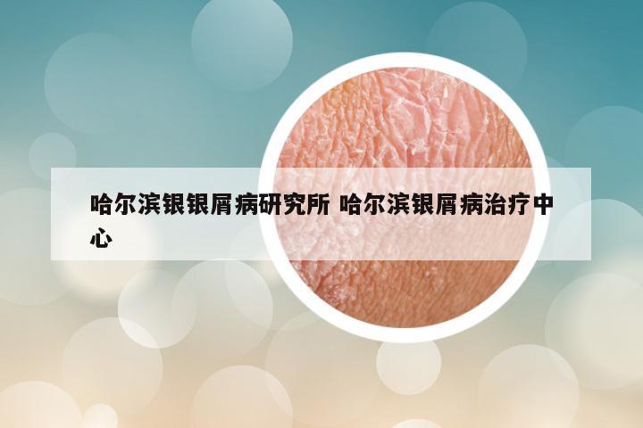 哈尔滨银银屑病研究所 哈尔滨银屑病治疗中心