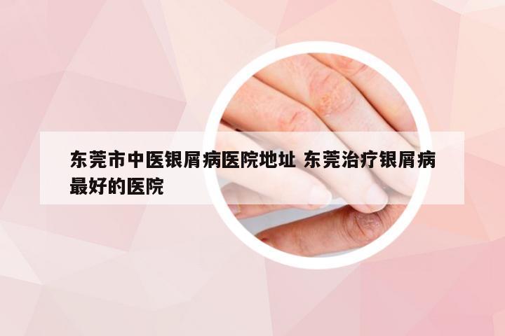 东莞市中医银屑病医院地址 东莞治疗银屑病最好的医院