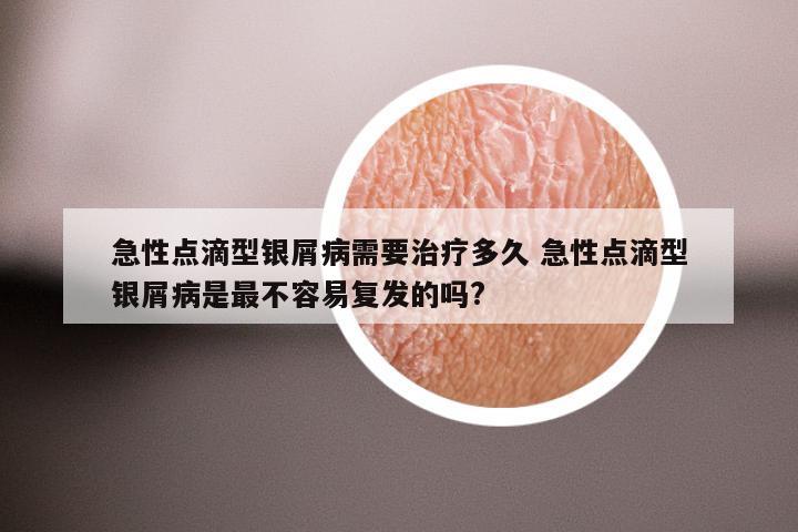 急性点滴型银屑病需要治疗多久 急性点滴型银屑病是最不容易复发的吗?