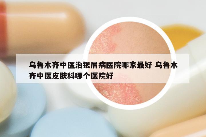 乌鲁木齐中医治银屑病医院哪家最好 乌鲁木齐中医皮肤科哪个医院好