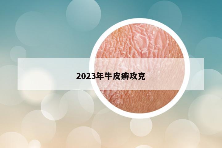 2023年牛皮癣攻克
