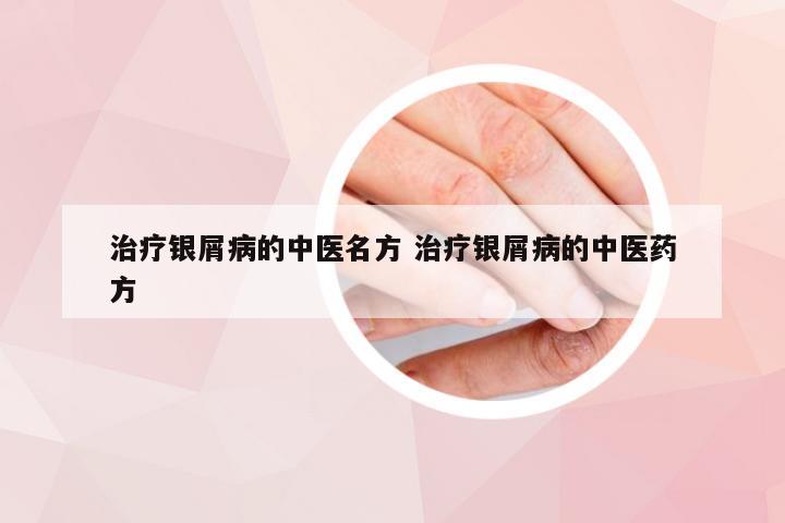 治疗银屑病的中医名方 治疗银屑病的中医药方