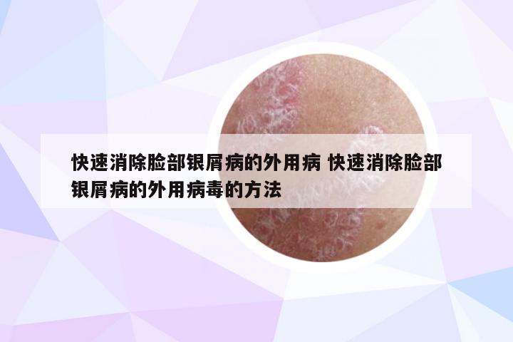 快速消除脸部银屑病的外用病 快速消除脸部银屑病的外用病毒的方法