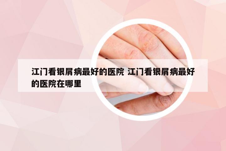 江门看银屑病最好的医院 江门看银屑病最好的医院在哪里
