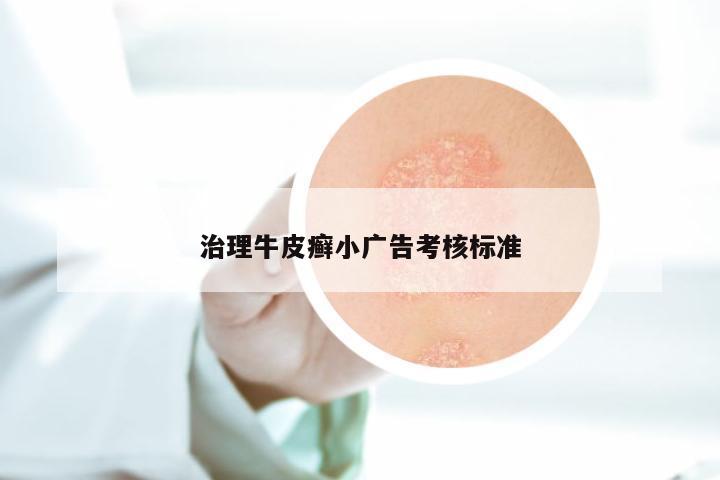 治理牛皮癣小广告考核标准