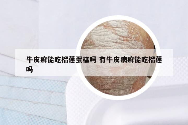牛皮癣能吃榴莲蛋糕吗 有牛皮病癣能吃榴莲吗