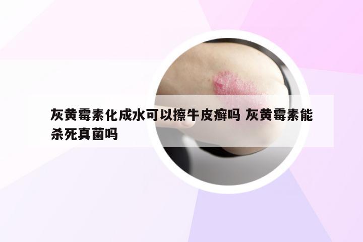 灰黄霉素化成水可以擦牛皮癣吗 灰黄霉素能杀死真菌吗