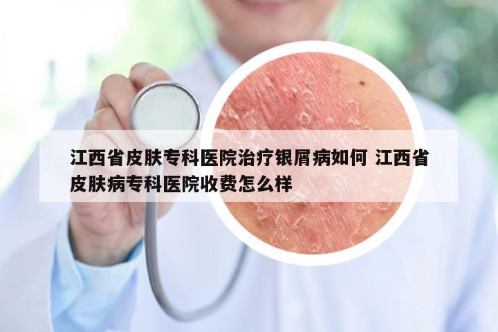 江西省皮肤专科医院治疗银屑病如何 江西省皮肤病专科医院收费怎么样