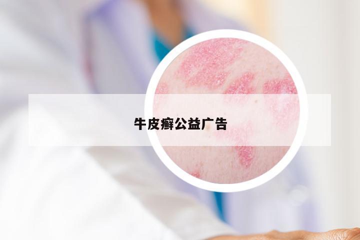 牛皮癣公益广告