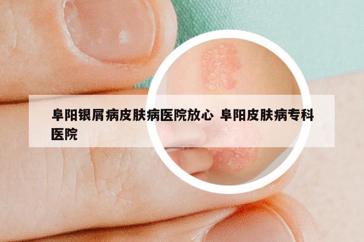 阜阳银屑病皮肤病医院放心 阜阳皮肤病专科医院
