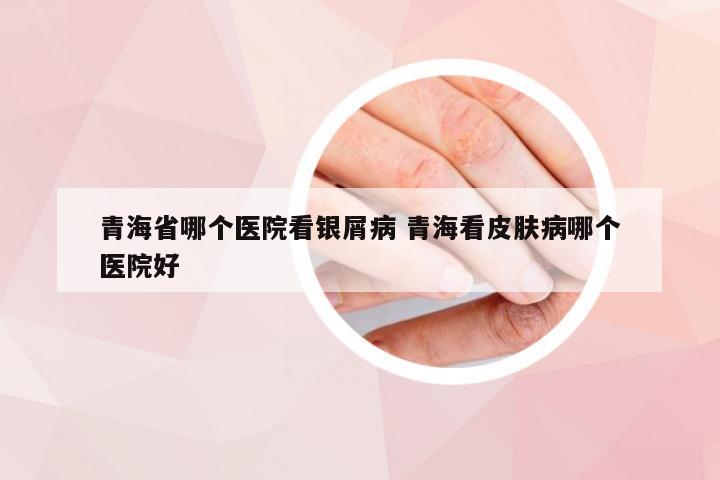 青海省哪个医院看银屑病 青海看皮肤病哪个医院好