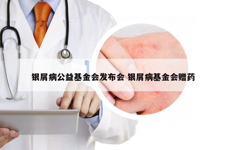 银屑病公益基金会发布会 银屑病基金会赠药