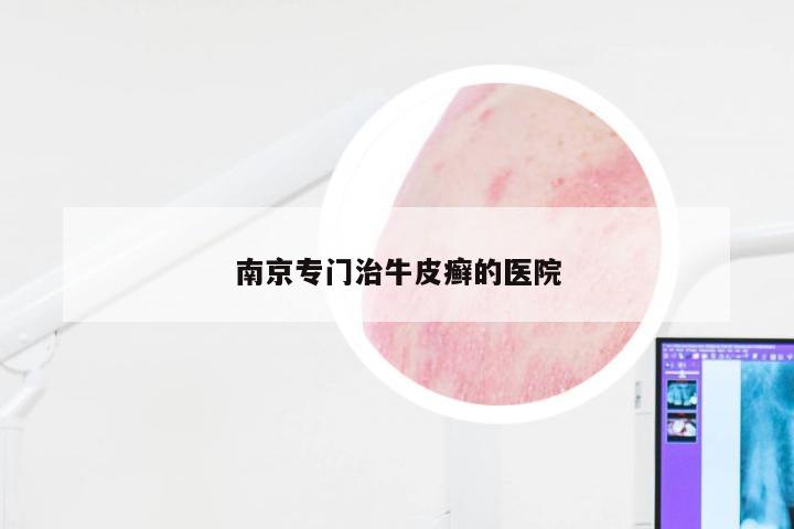 南京专门治牛皮癣的医院