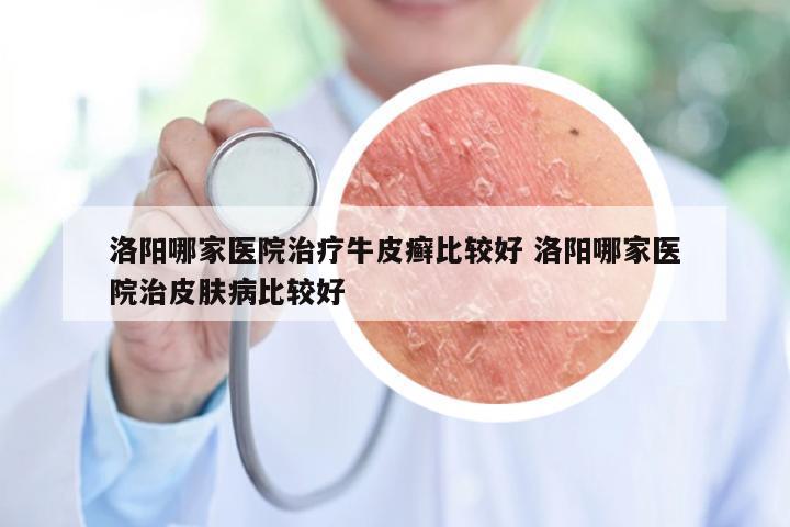 洛阳哪家医院治疗牛皮癣比较好 洛阳哪家医院治皮肤病比较好