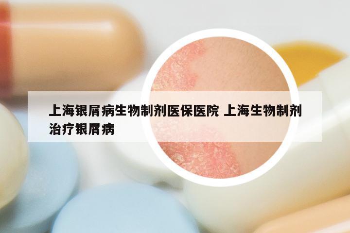 上海银屑病生物制剂医保医院 上海生物制剂治疗银屑病