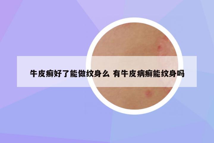牛皮癣好了能做纹身么 有牛皮病癣能纹身吗