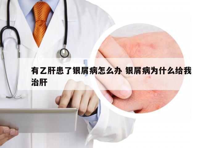 有乙肝患了银屑病怎么办 银屑病为什么给我治肝