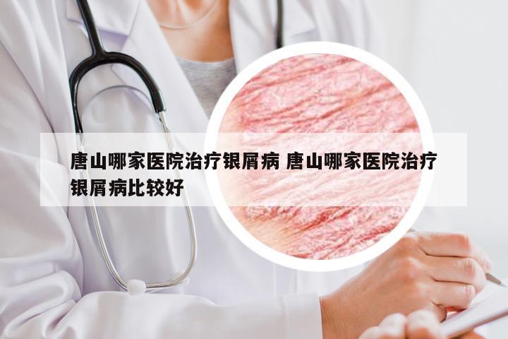 唐山哪家医院治疗银屑病 唐山哪家医院治疗银屑病比较好