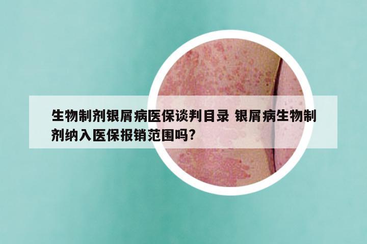 生物制剂银屑病医保谈判目录 银屑病生物制剂纳入医保报销范围吗?