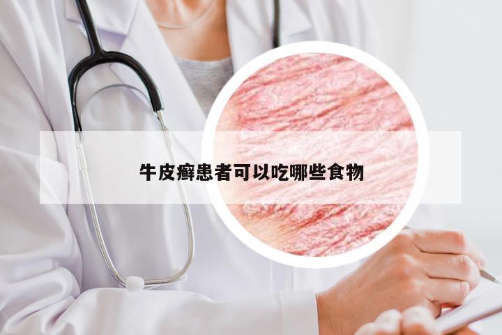 牛皮癣患者可以吃哪些食物