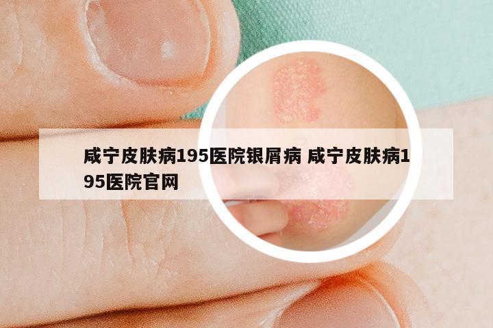 咸宁皮肤病195医院银屑病 咸宁皮肤病195医院官网