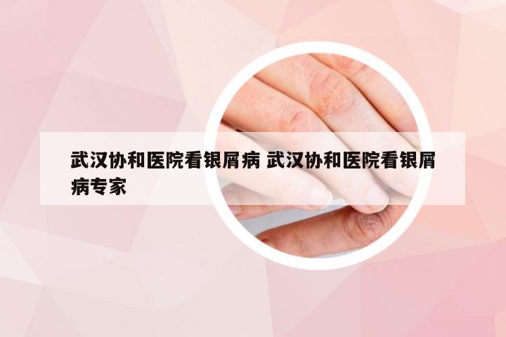 武汉协和医院看银屑病 武汉协和医院看银屑病专家