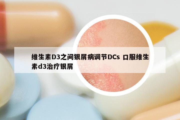 维生素D3之间银屑病调节DCs 口服维生素d3治疗银屑
