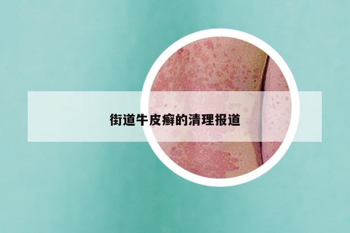 街道牛皮癣的清理报道