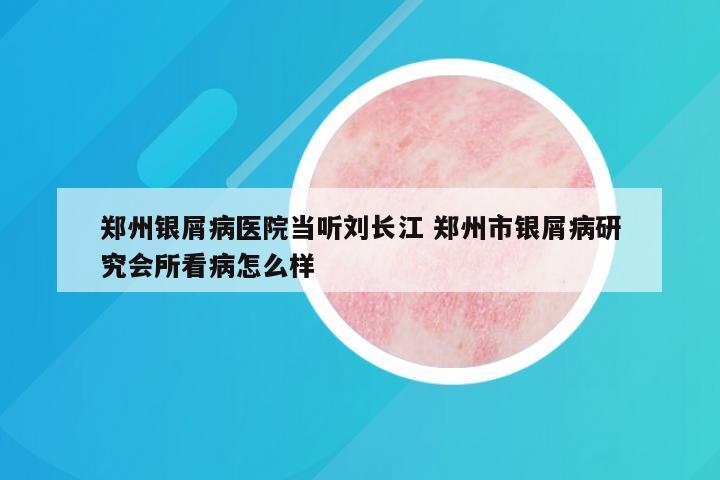 郑州银屑病医院当听刘长江 郑州市银屑病研究会所看病怎么样