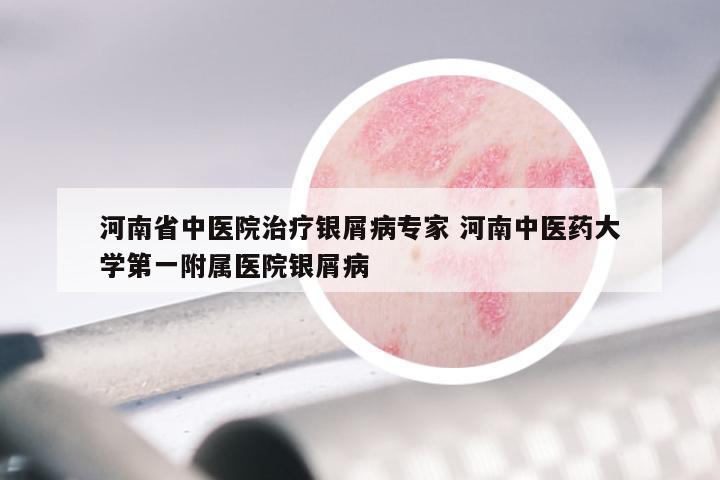 河南省中医院治疗银屑病专家 河南中医药大学第一附属医院银屑病