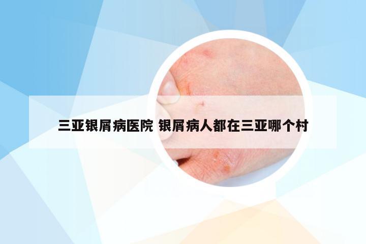 三亚银屑病医院 银屑病人都在三亚哪个村