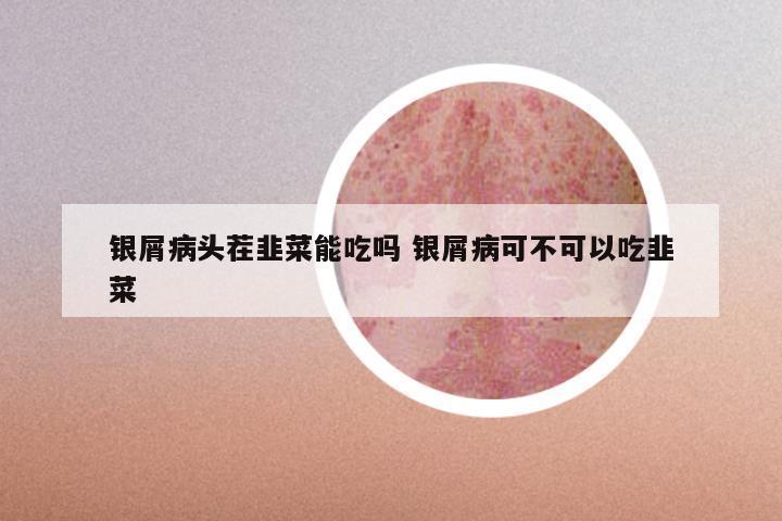 银屑病头茬韭菜能吃吗 银屑病可不可以吃韭菜