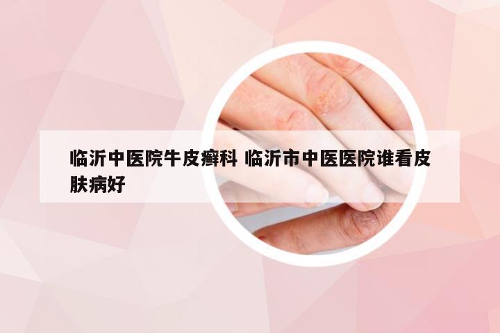 临沂中医院牛皮癣科 临沂市中医医院谁看皮肤病好