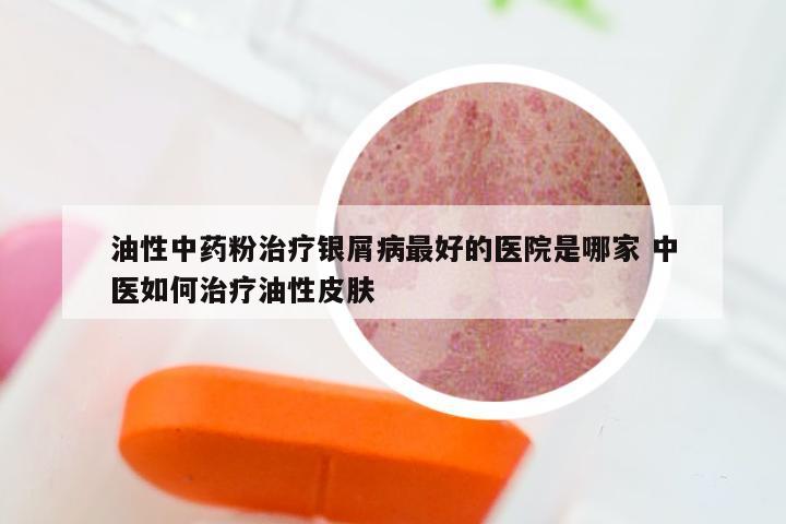 油性中药粉治疗银屑病最好的医院是哪家 中医如何治疗油性皮肤