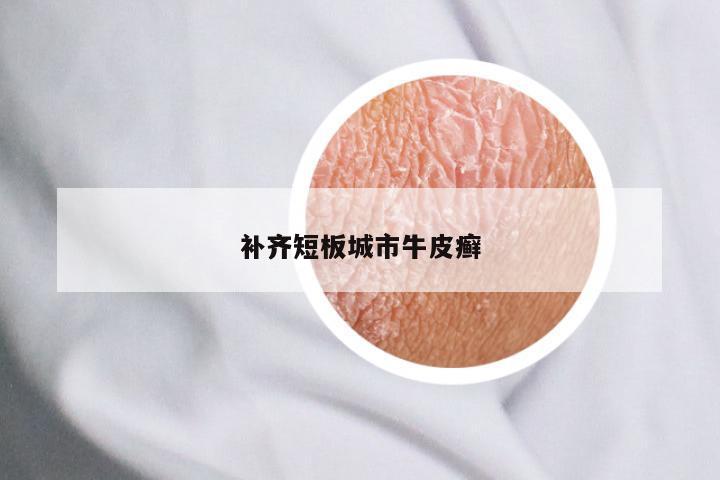 补齐短板城市牛皮癣