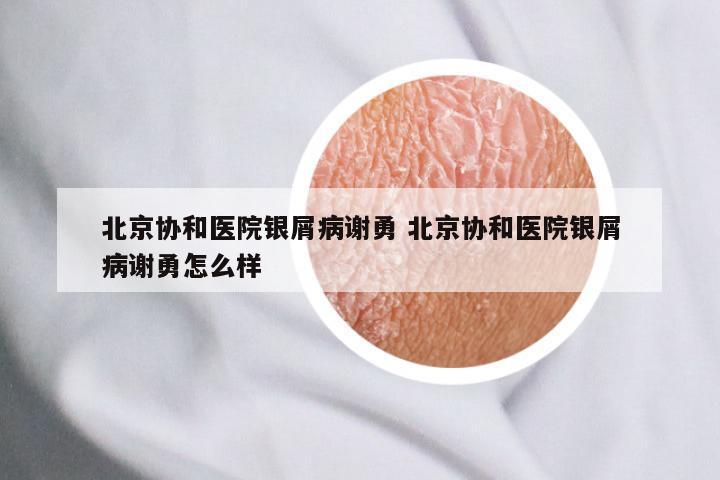 北京协和医院银屑病谢勇 北京协和医院银屑病谢勇怎么样