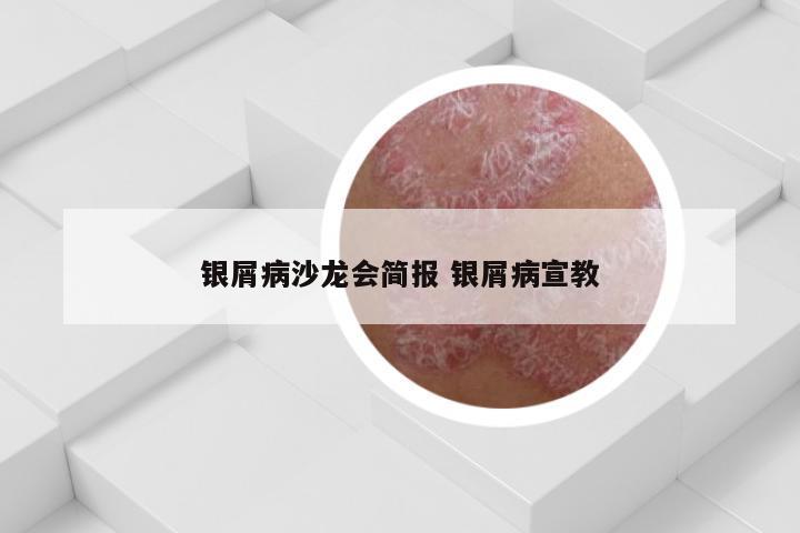 银屑病沙龙会简报 银屑病宣教