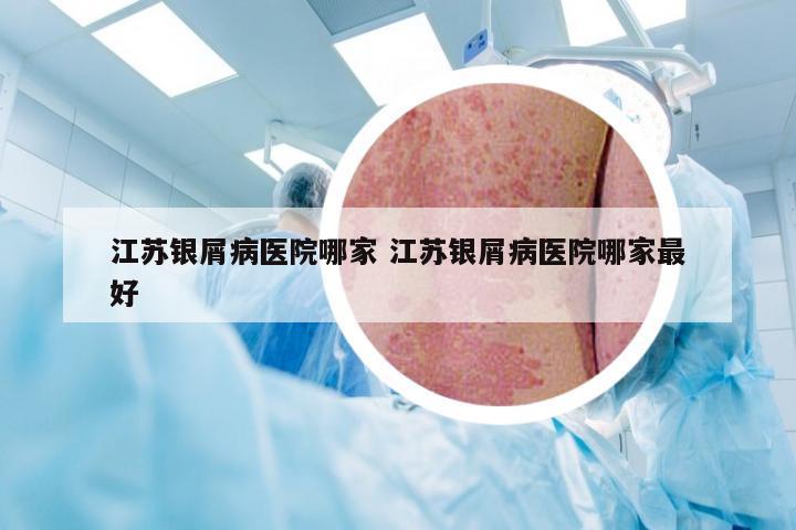 江苏银屑病医院哪家 江苏银屑病医院哪家最好