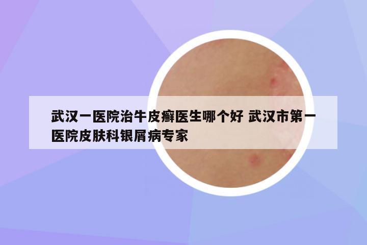 武汉一医院治牛皮癣医生哪个好 武汉市第一医院皮肤科银屑病专家
