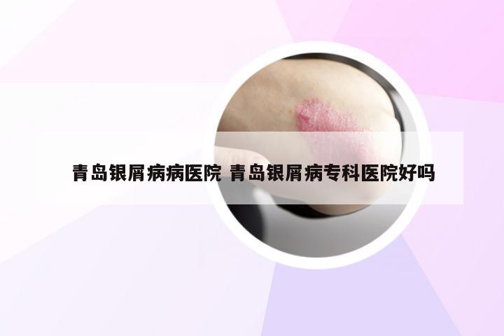 青岛银屑病病医院 青岛银屑病专科医院好吗